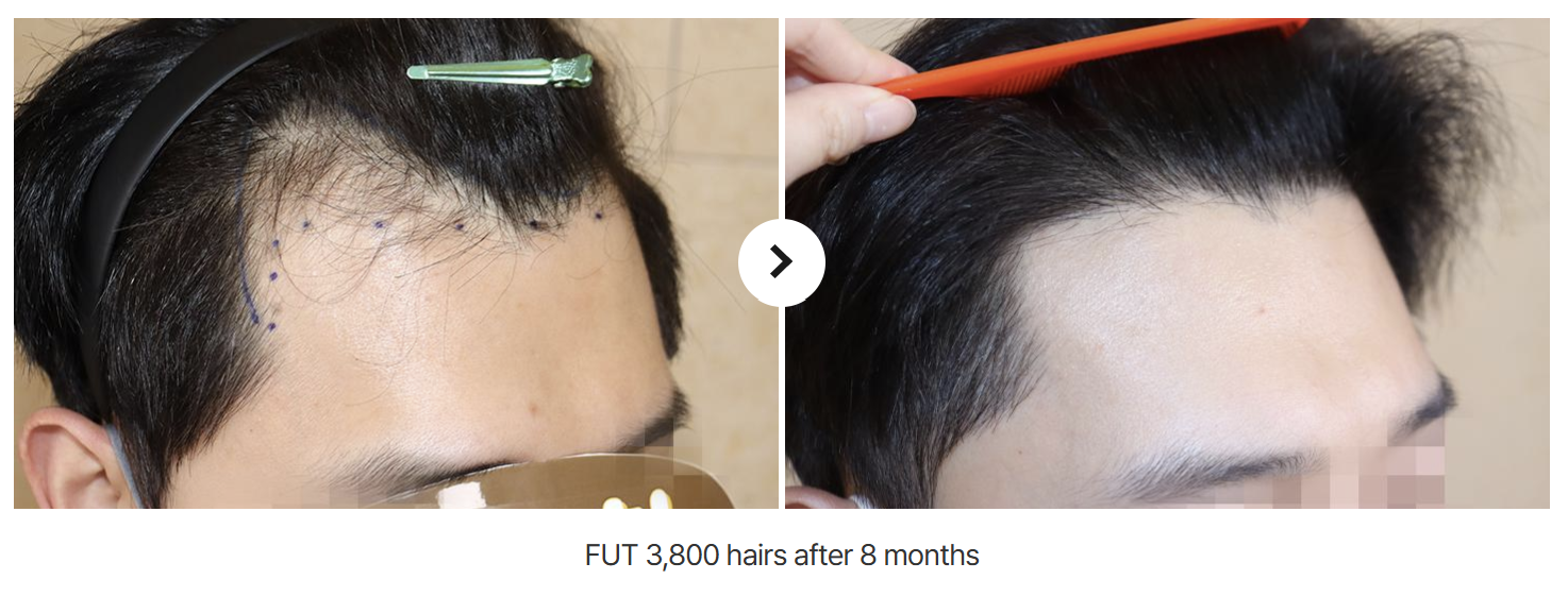 haira