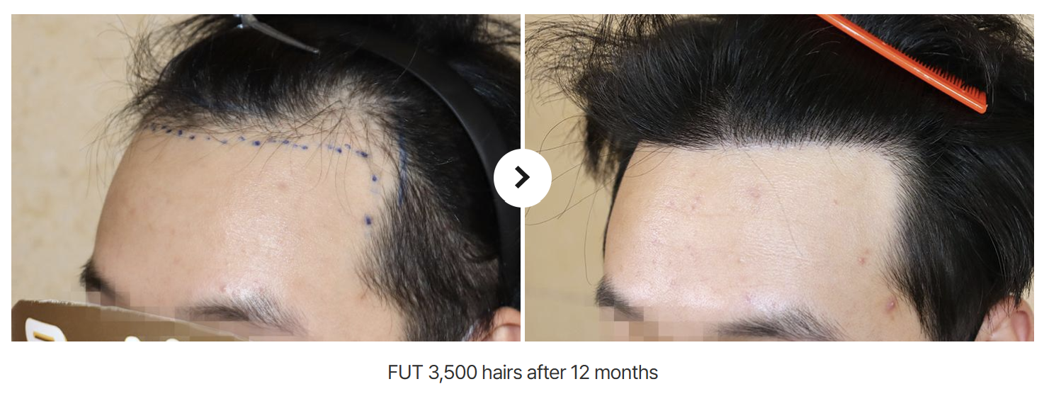 hairb