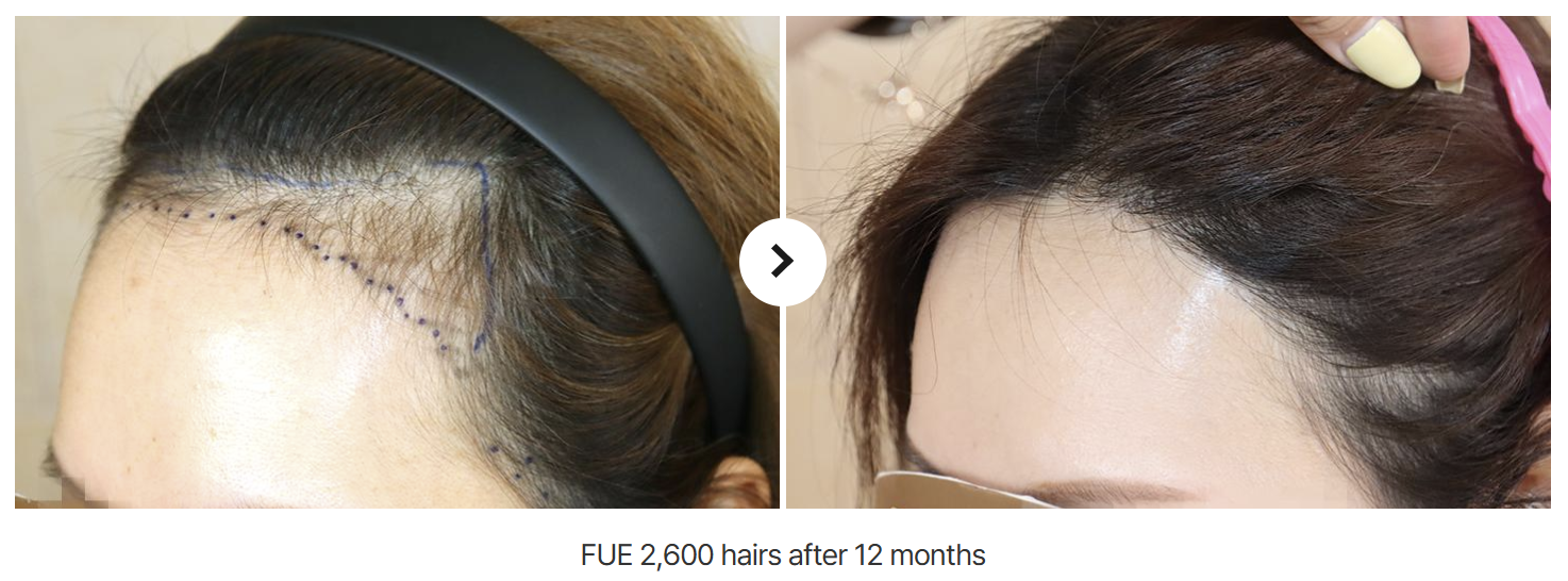 hairc