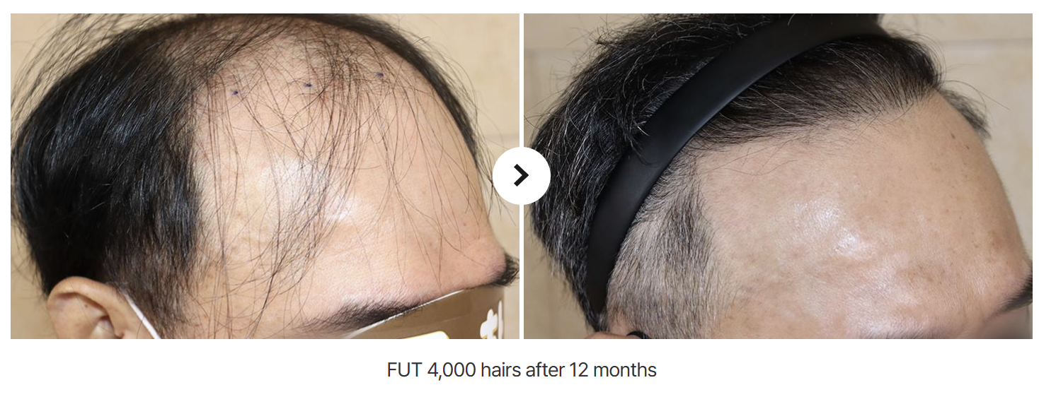 hairf