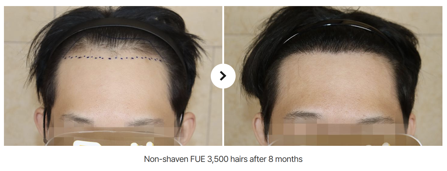 hairkorea5