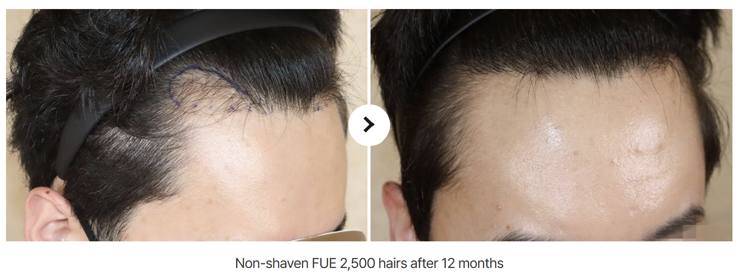 hairkorea6